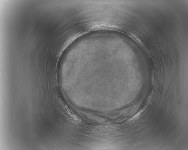 X0000057080877200510010157