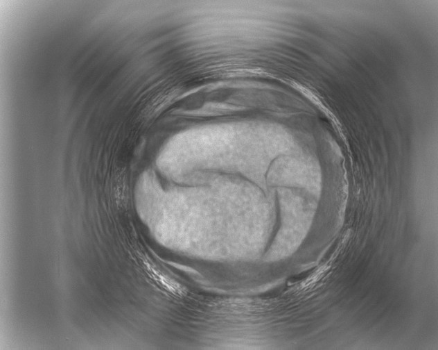 X0000057080897200510010156