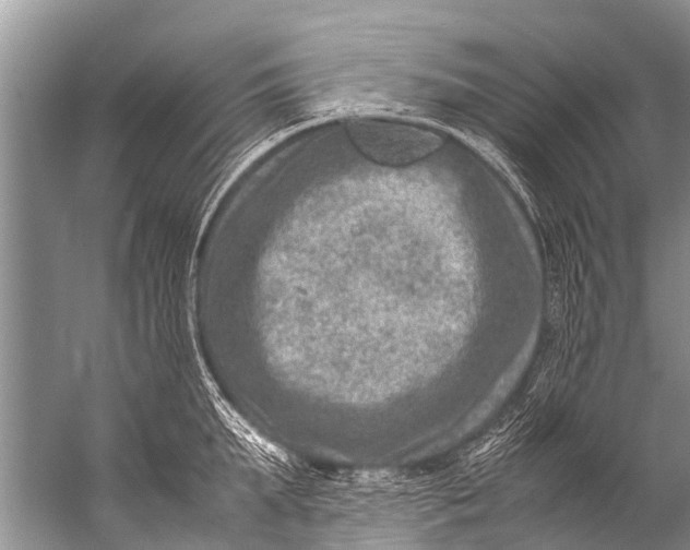 X0000057080903200510010156