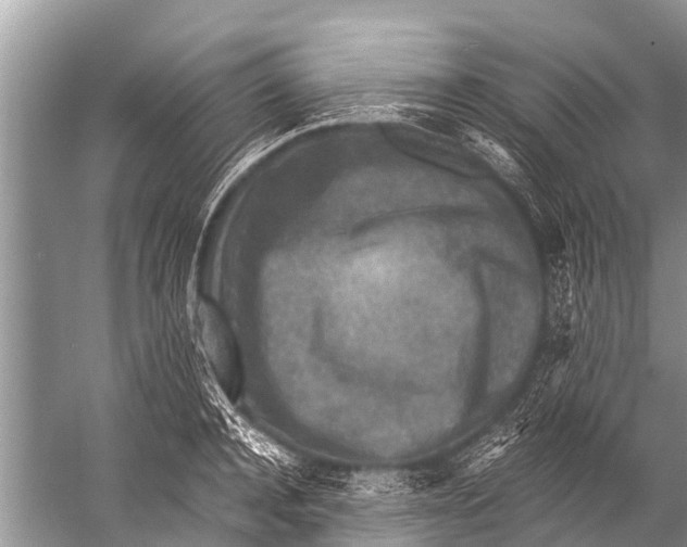 X0000057080944200510010156