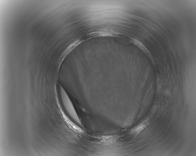 X0000057080946200510010156