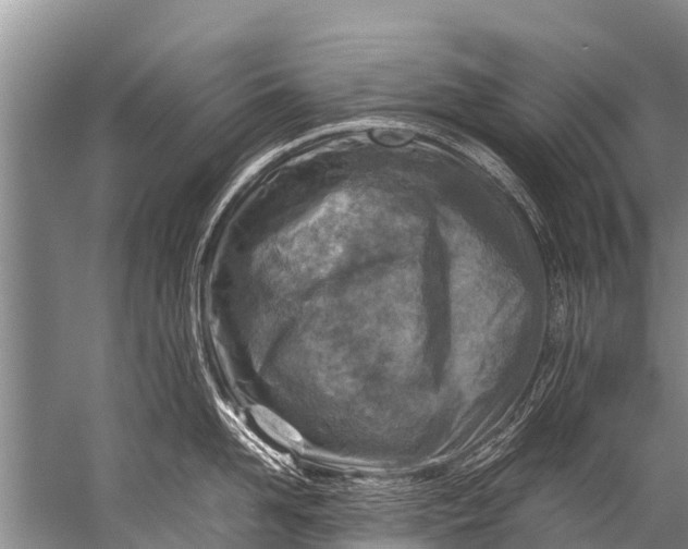 X0000057080958200510010156