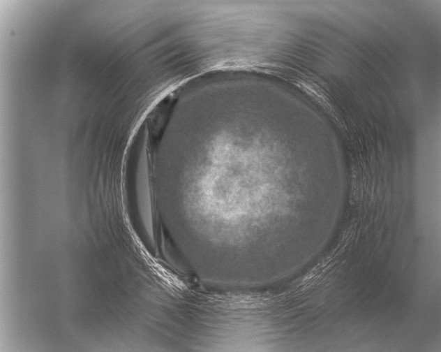 X0000057080976200510010155