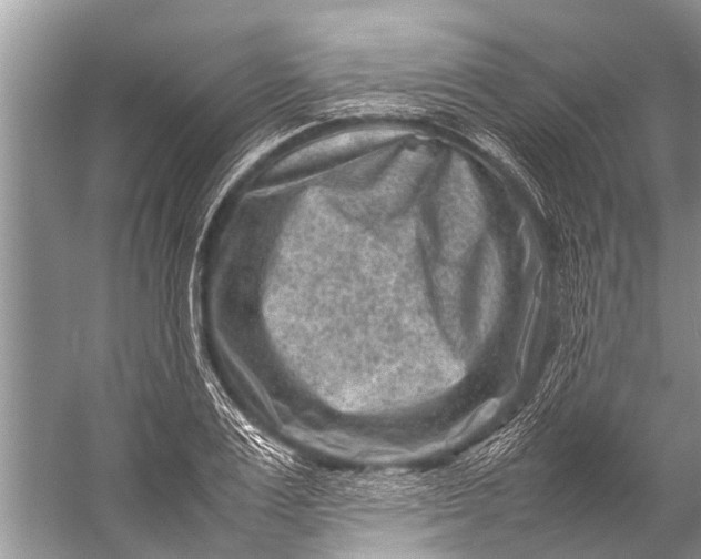 X0000057080983200510010155