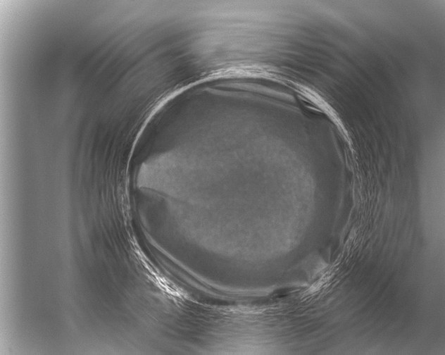 X0000057080996200510010155