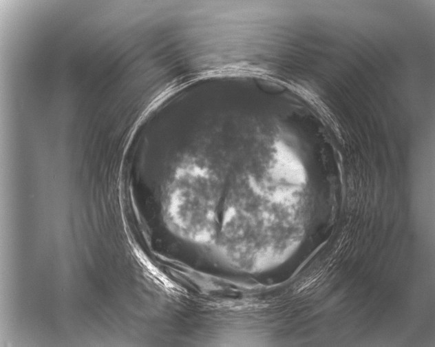 X0000057080998200510010155