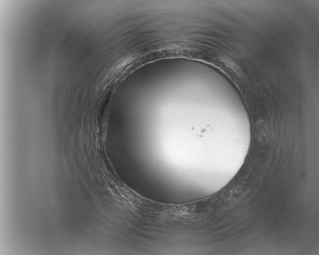 X0000057081111200510010152