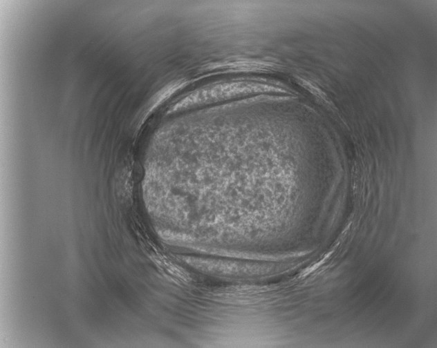 X0000057081163200510010152