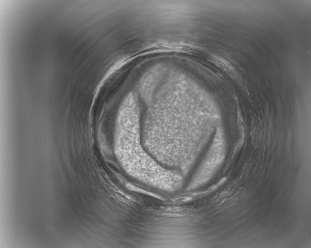 X0000057081172200510010152