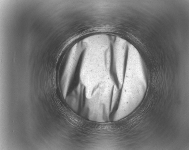 X0000057081174200510010152