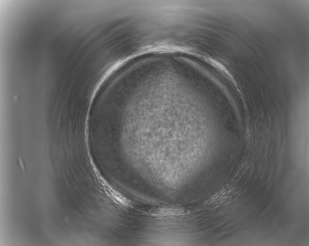 X0000057081183200510010152