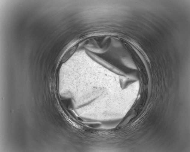 X0000057081197200510010151