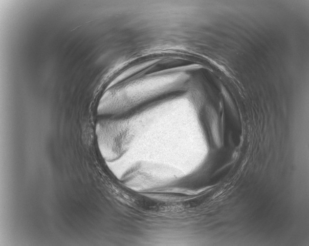 X0000057081363200510010148