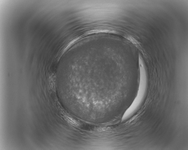 X0000057081369200510010148