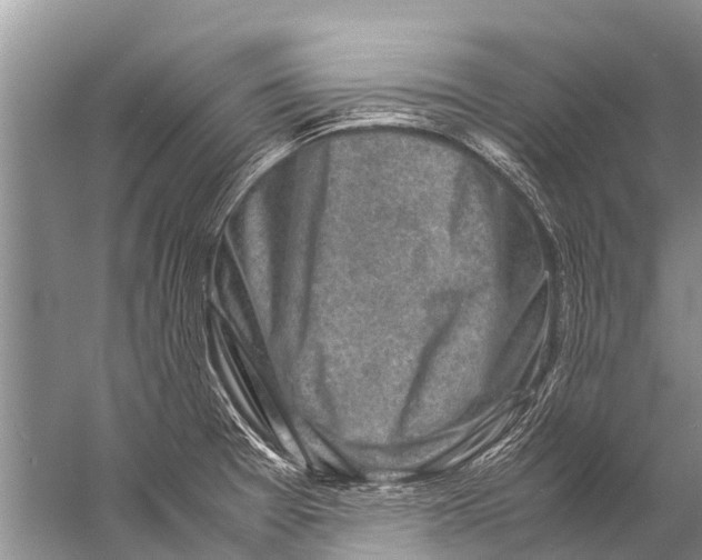 X0000057081377200510010148