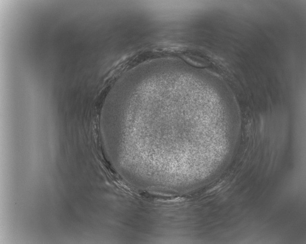 X0000057081397200510010147