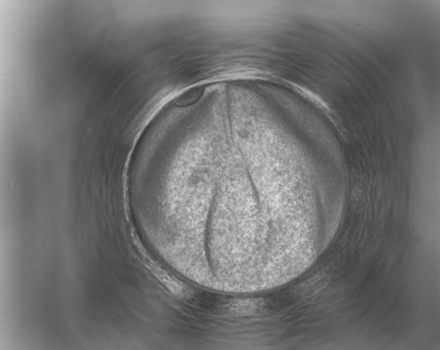 X0000057081423200510010148