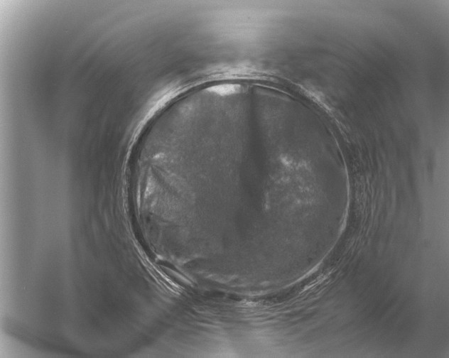 X0000057081463200510010147