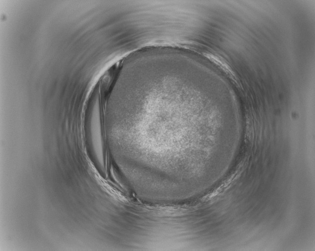 X0000057080976200510071841