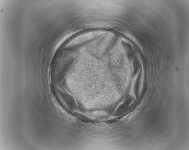 X0000057080983200510071841