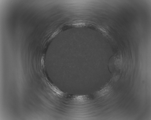 X0000057100382200509121014