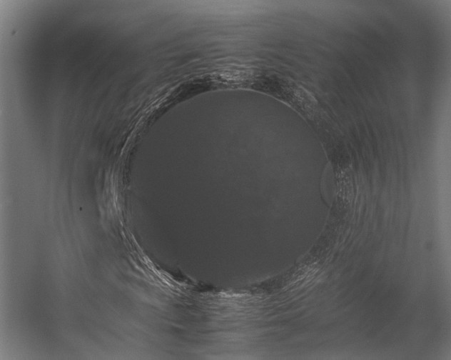 X0000057101009200509121002