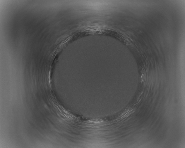 X0000057101156200509121000