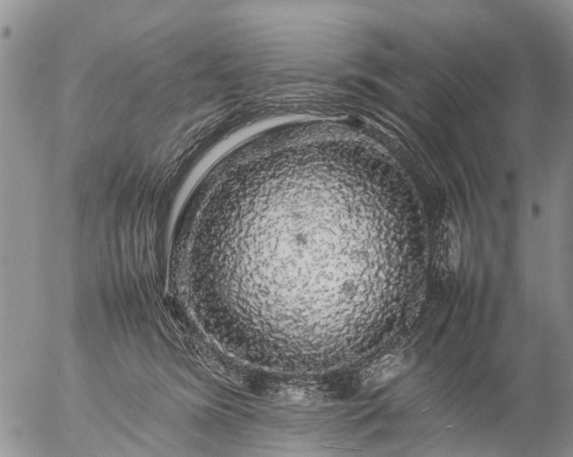 X0000057100420200509161659