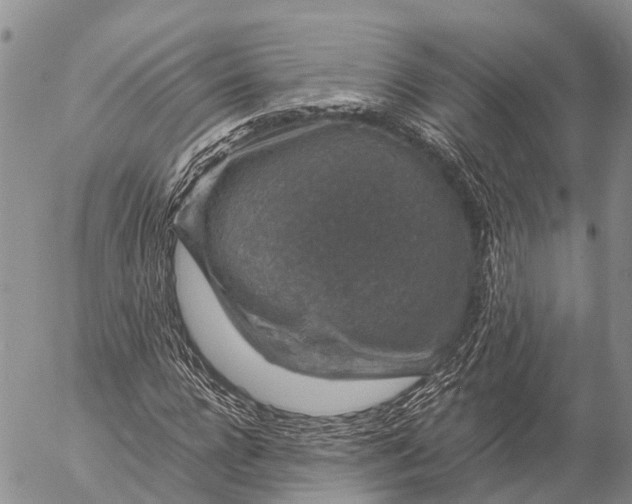 X0000057100920200509231712