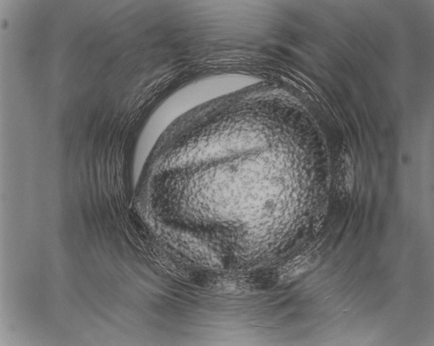 X0000057100420200509301622