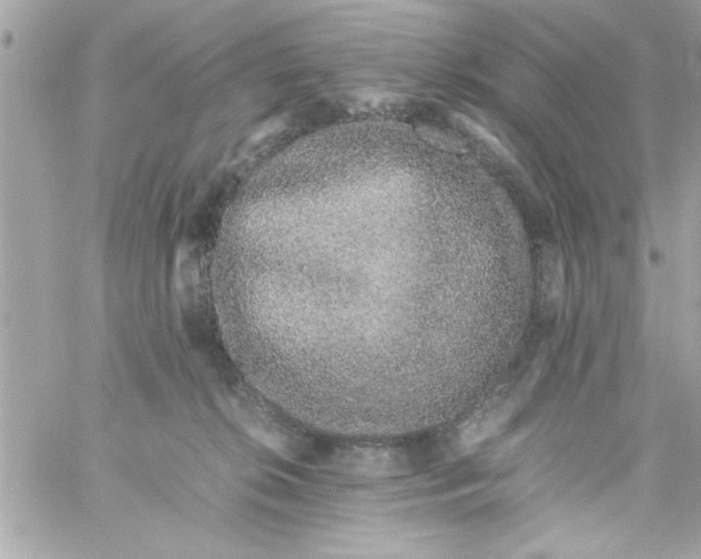 X0000057100276200510071945