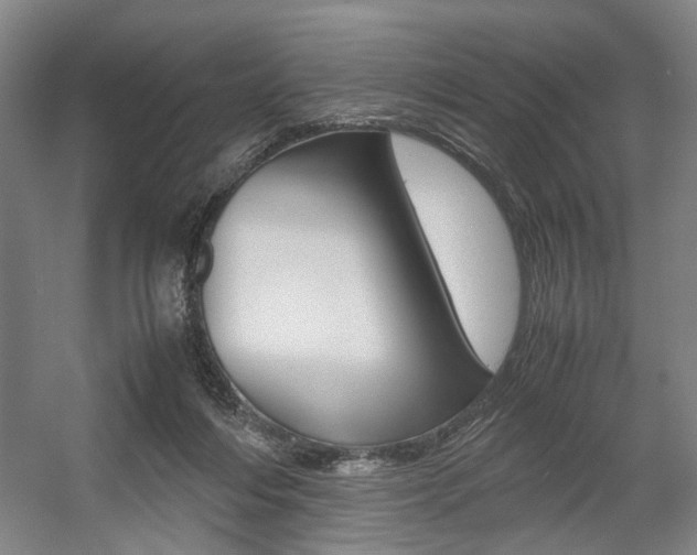X0000057560216200509160819