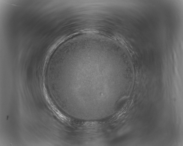 X0000057560145200509161012