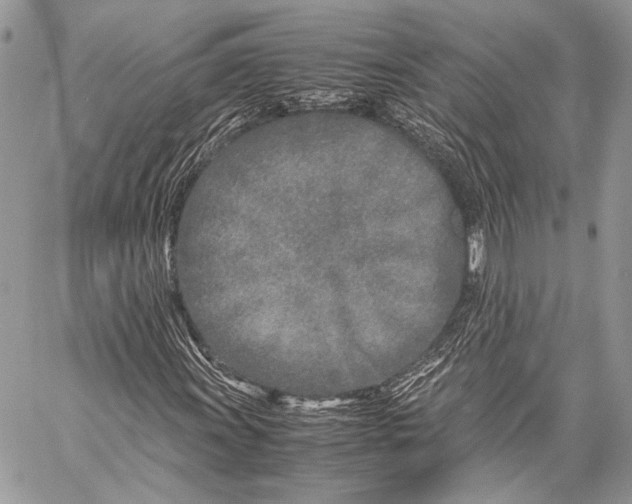 X0000057561011200510071512