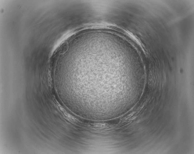 X0000057561456200510071505
