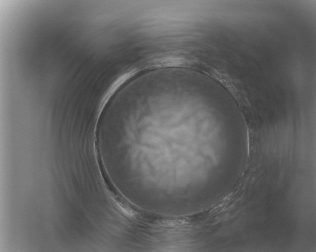 X0000057570147200509302120