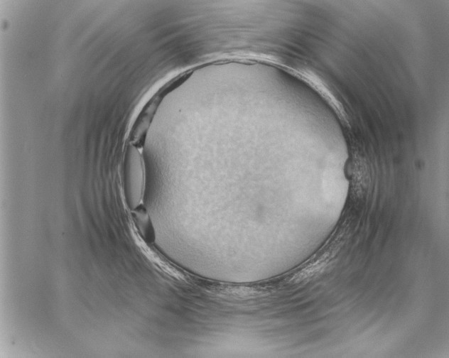 X0000057581100200510171701