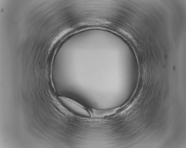 X0000057581114200510171701