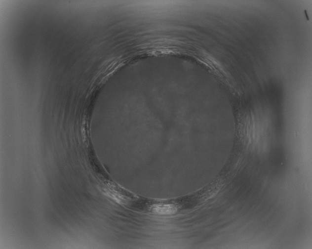 X0000058100169200509231009
