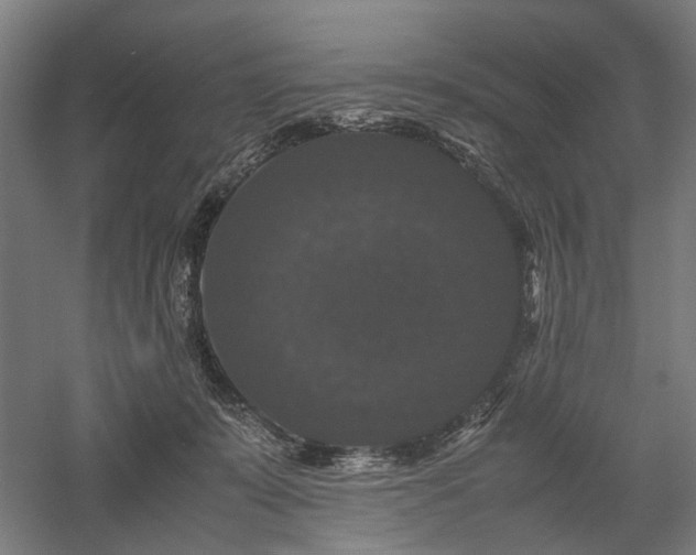 X0000058100319200509231006