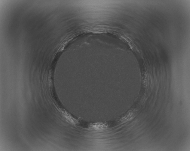 X0000058100466200509231004