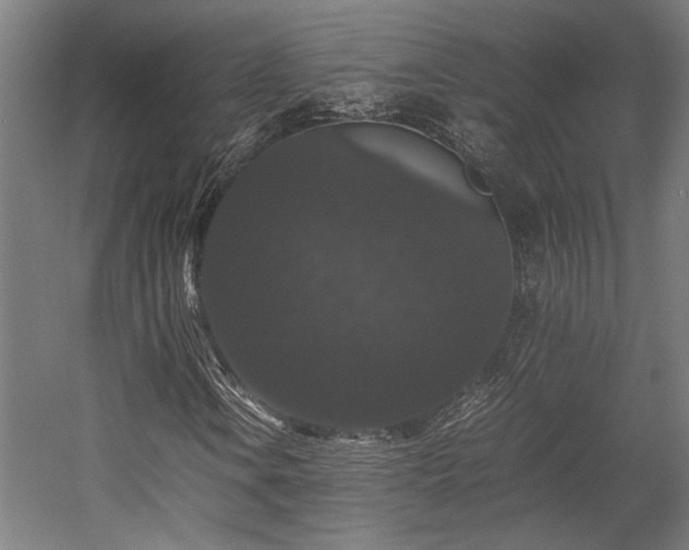 X0000058101106200509230952