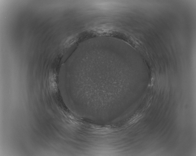 X0000058101156200510071839
