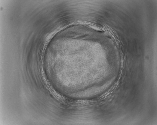 X0000058120145200510171319