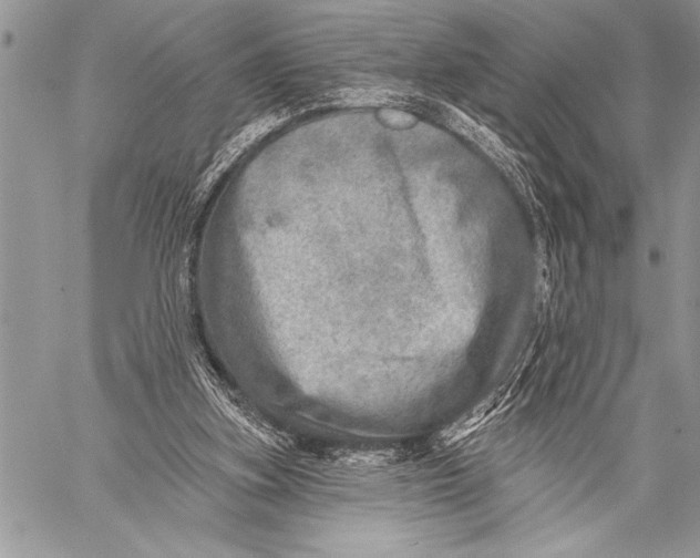 X0000058120155200510171319