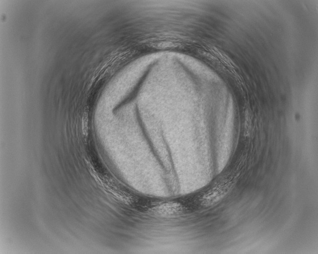 X0000058120210200510171319