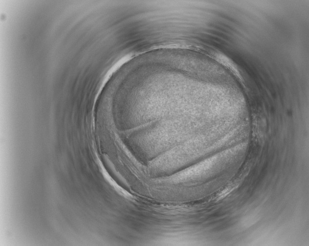 X0000058121095200510212014