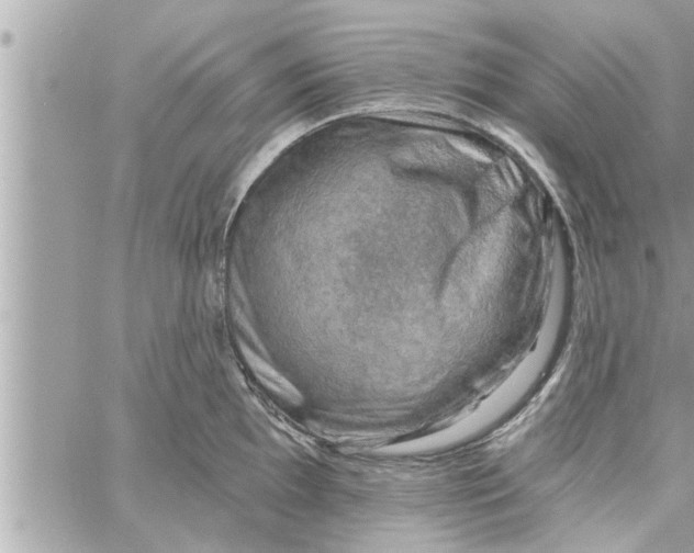 X0000058121097200510212014