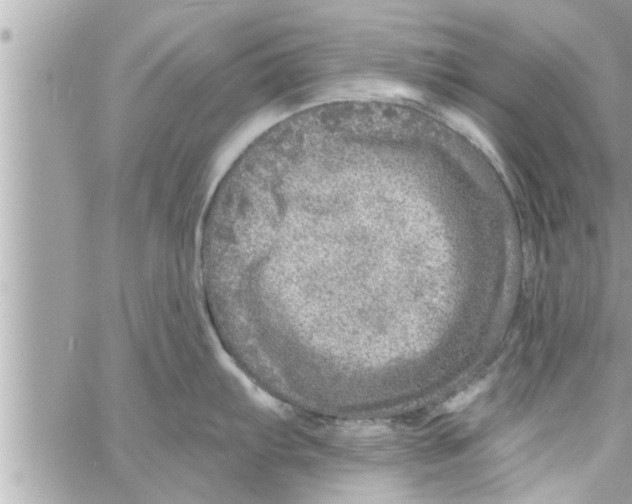 X0000058121103200510212014