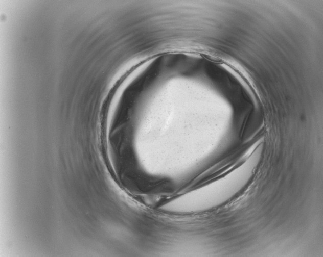 X0000058121147200510212014